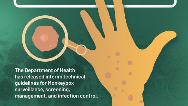 Davao City formulates measures vs Monkeypox