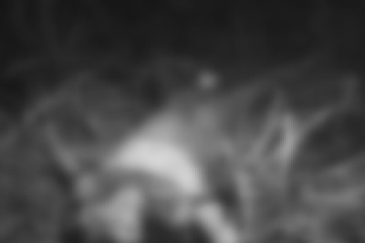 Motor drayber, angkas patay human ma-aksidente