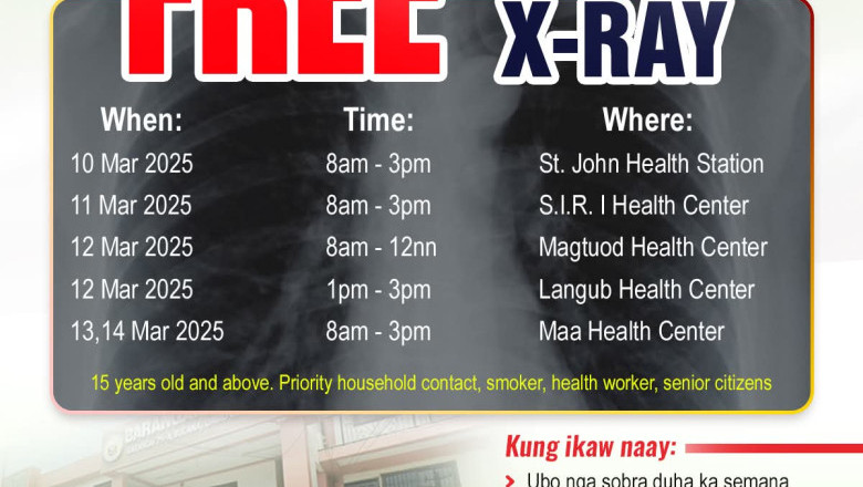 Free chest X-Ray for Dabawenyos