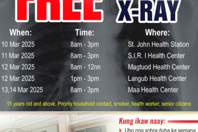 Free chest X-Ray for Dabawenyos