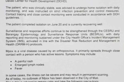 First case of Mpox confirmed in Mati City